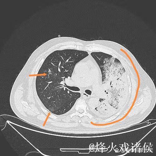 埃迪-豪:得肺炎住院后,意识到医疗体系与医护人员至关重要 埃迪-豪:得肺炎住院后,意识到医疗体系与医护人员至关重要